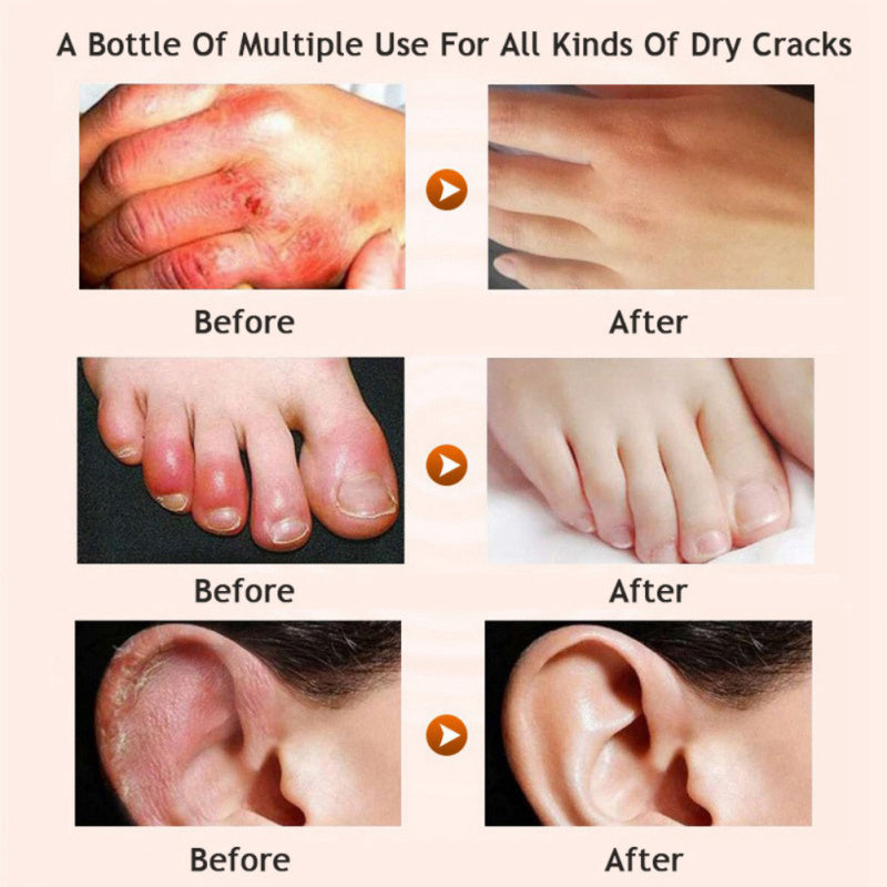 Honey moisturizing cream foot cream leg cream Honey moisturizing cream foot cream leg cream
